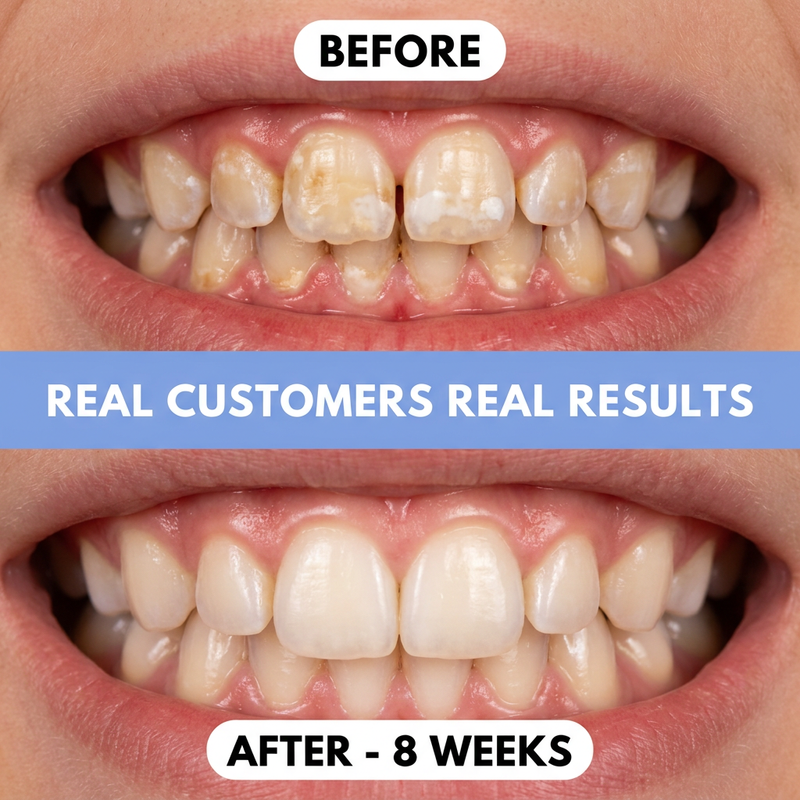 1. Yes — cavities can be reversed (and this is how)